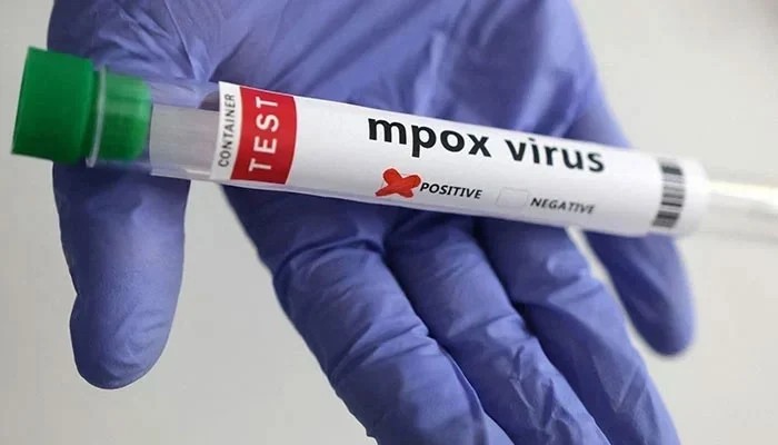 Karachi Reports Second Mpox Case In Two Days, Sindh's Tally Rises To 43